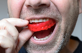 Man with dental implants in Beverly, MA putting in mouthguard