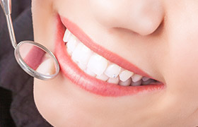 Closeup of healthy smile during dental exam