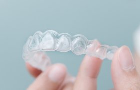 Closeup of clear aligners