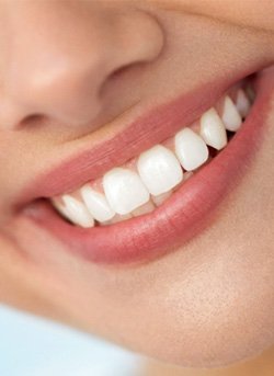 Smiling child pointing to their tooth