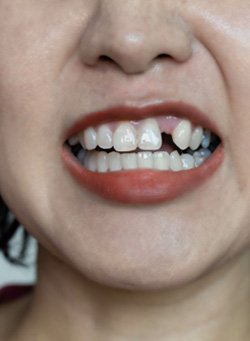 Smiling child pointing to their tooth