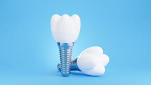 A pair of dental implants on a blue background